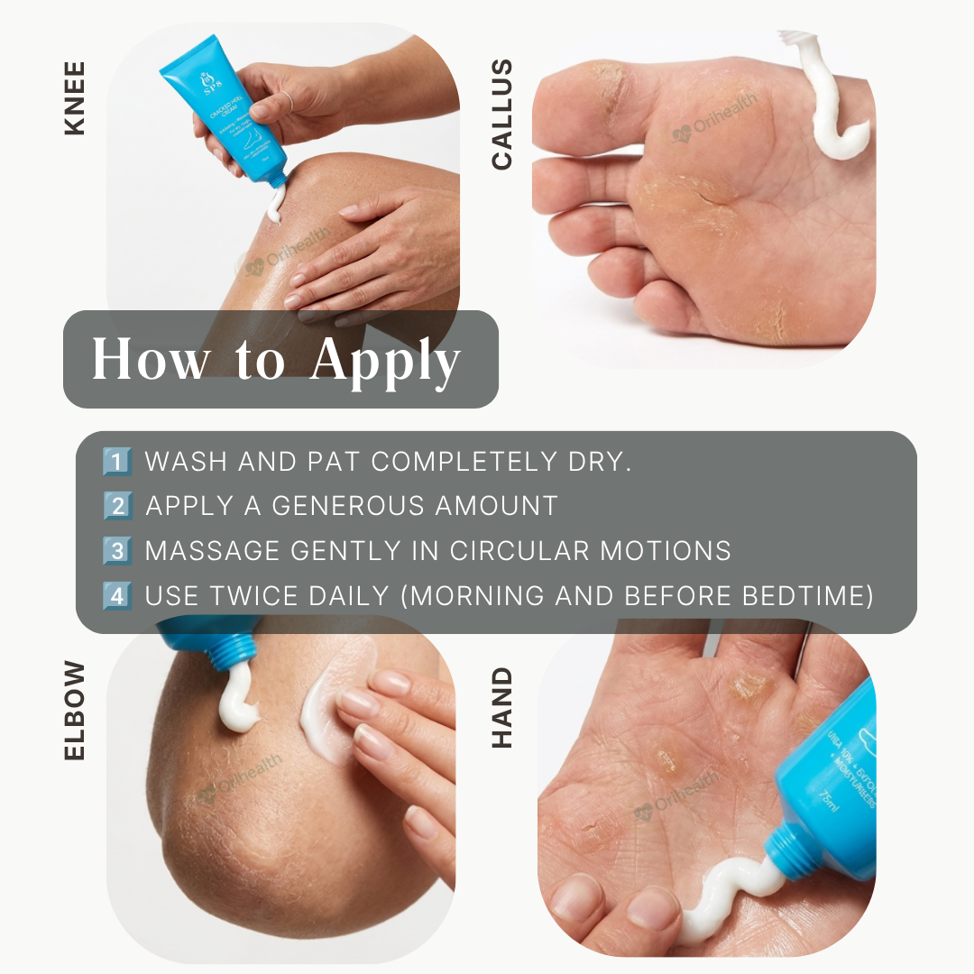 SP8 Cracked Heel Cream 75ml