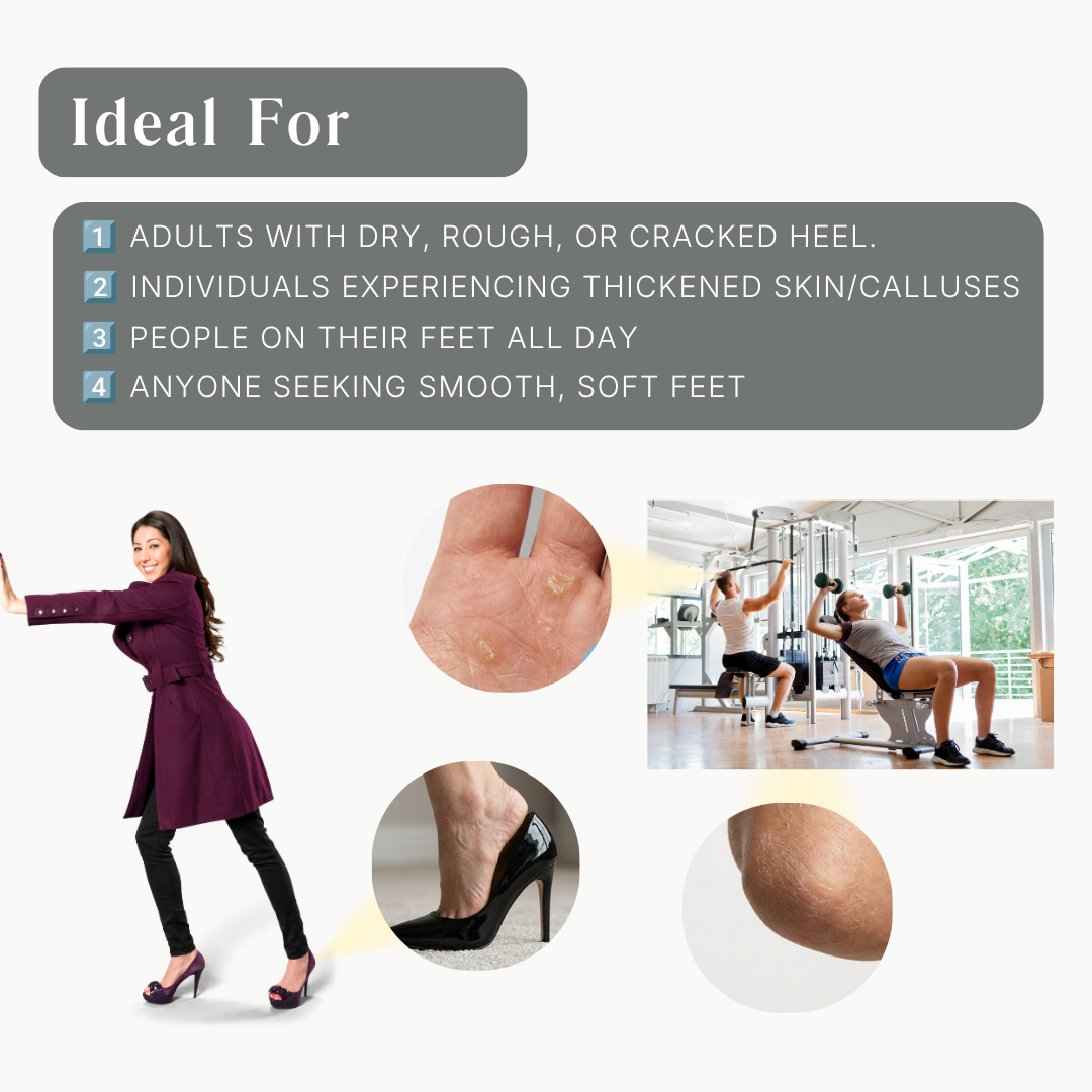 SP8 Cracked Heel Cream 75ml